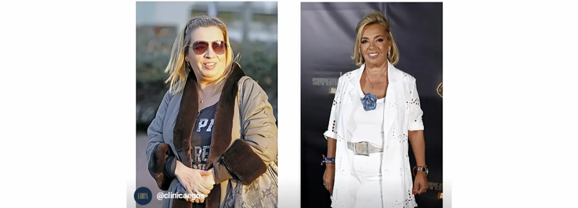 Los tratamientos secretos de Carmen Borrego