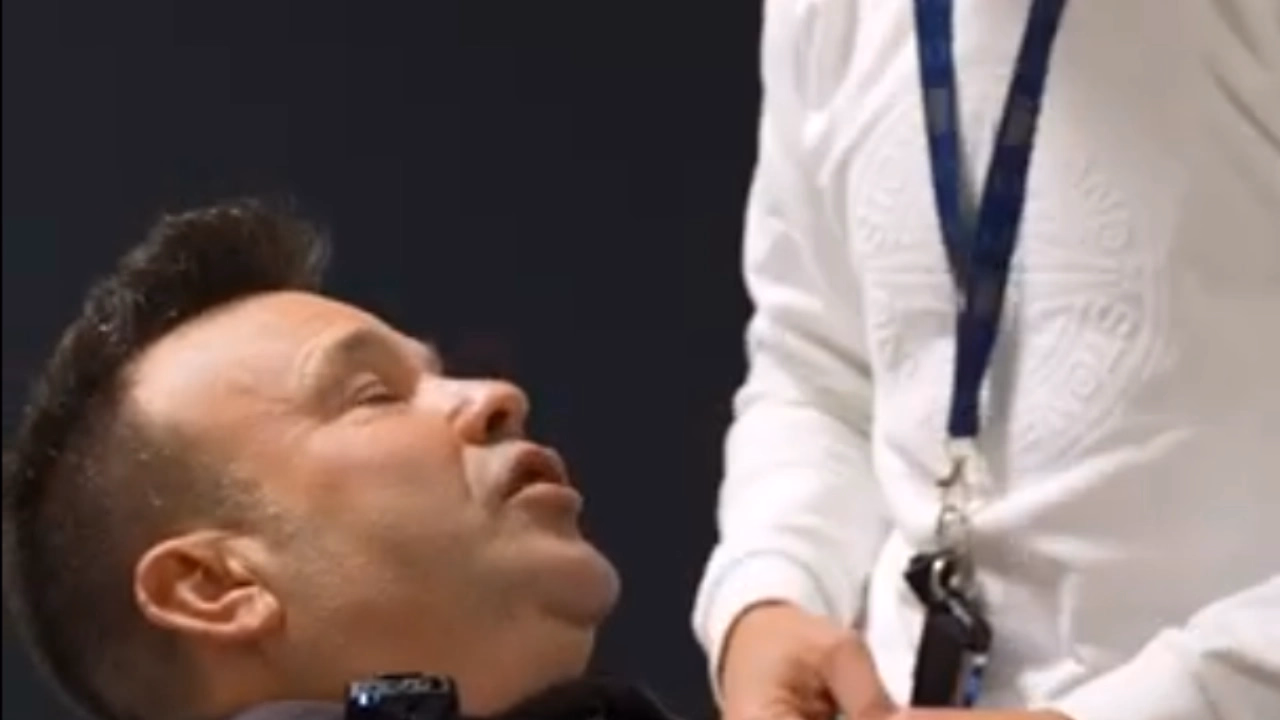 José elías and his striking facial rejuvenation at EGOS