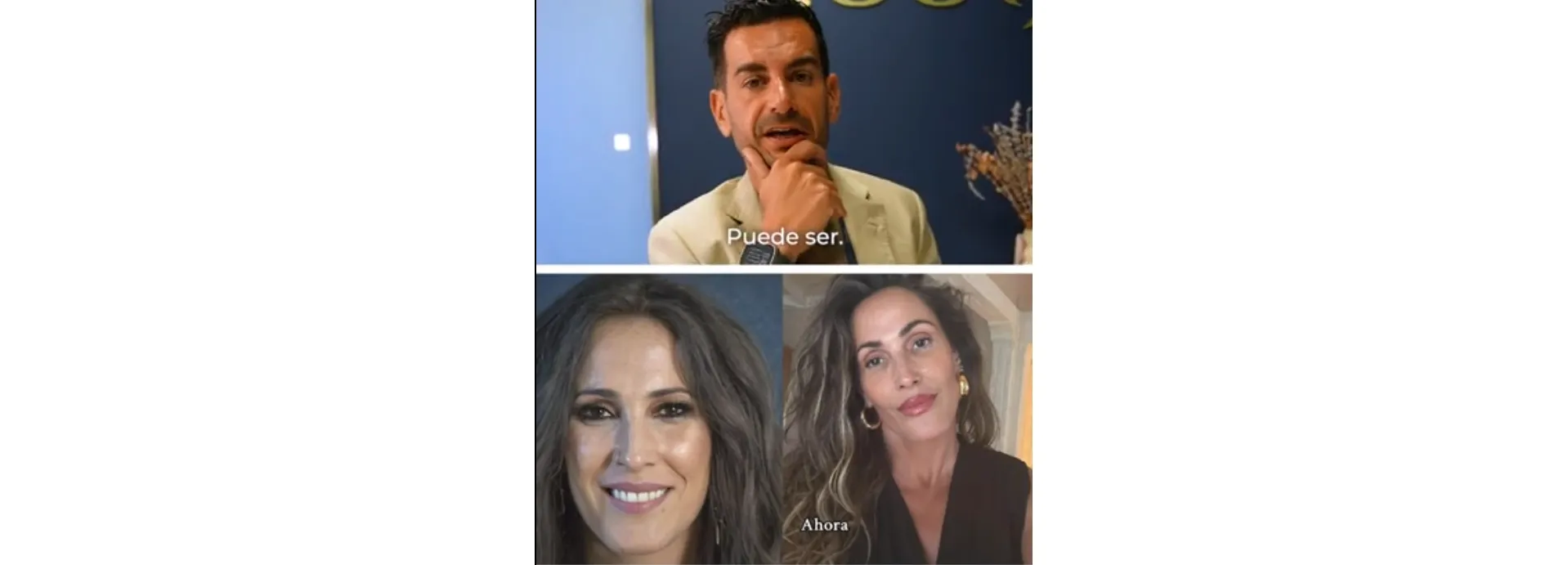¿Qué se ha hecho Malú? La opinión profesional de un doctor estético