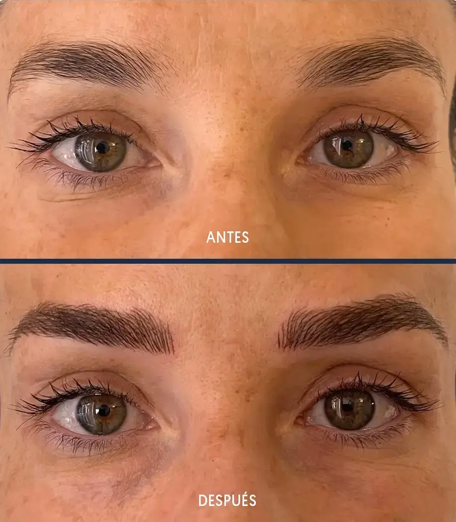 Paciente ideal para microblading técnica pelo a pelo