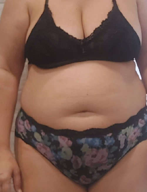 Antes de Liposucció VASER
