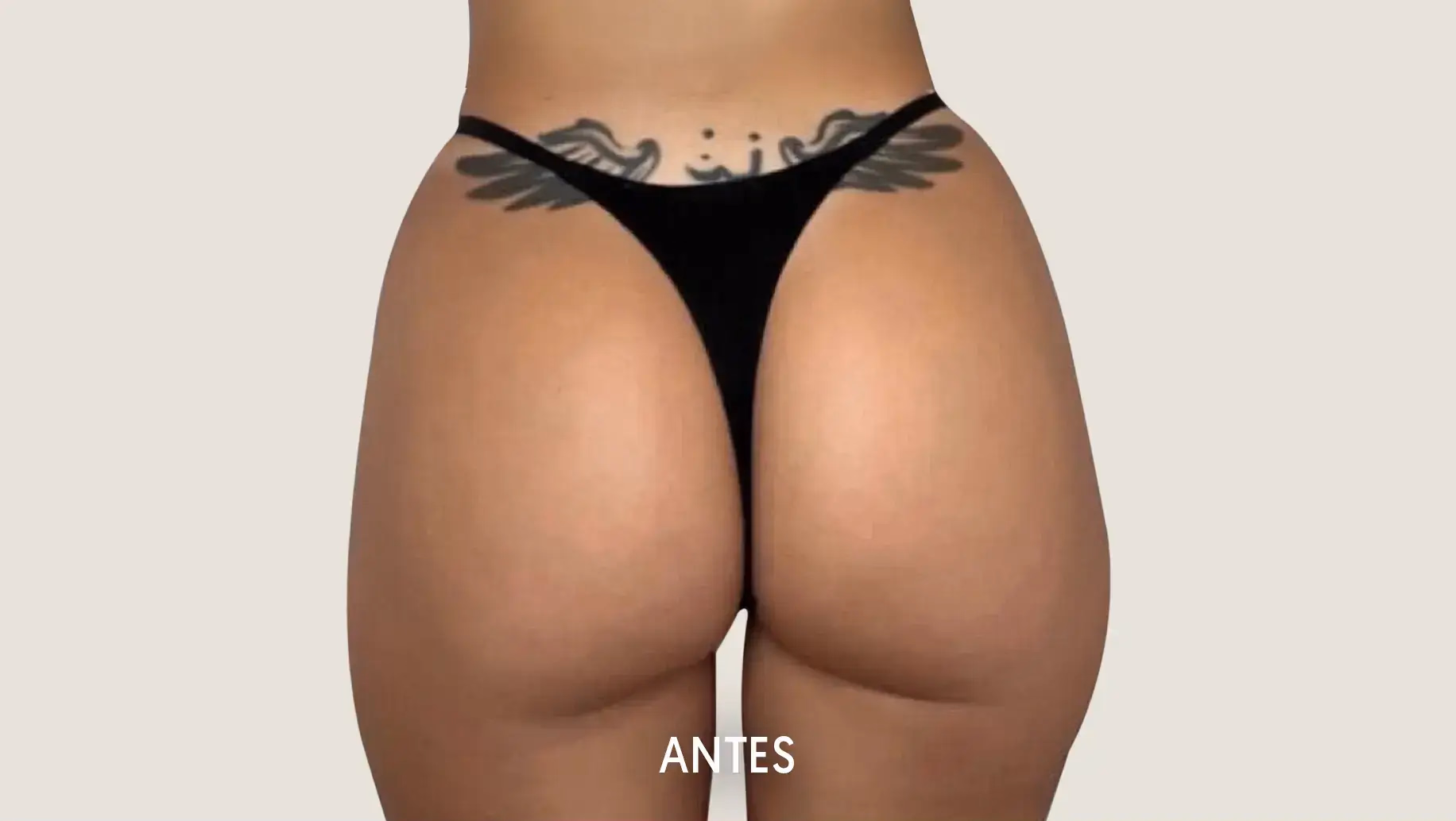 Antes de Hip Dips