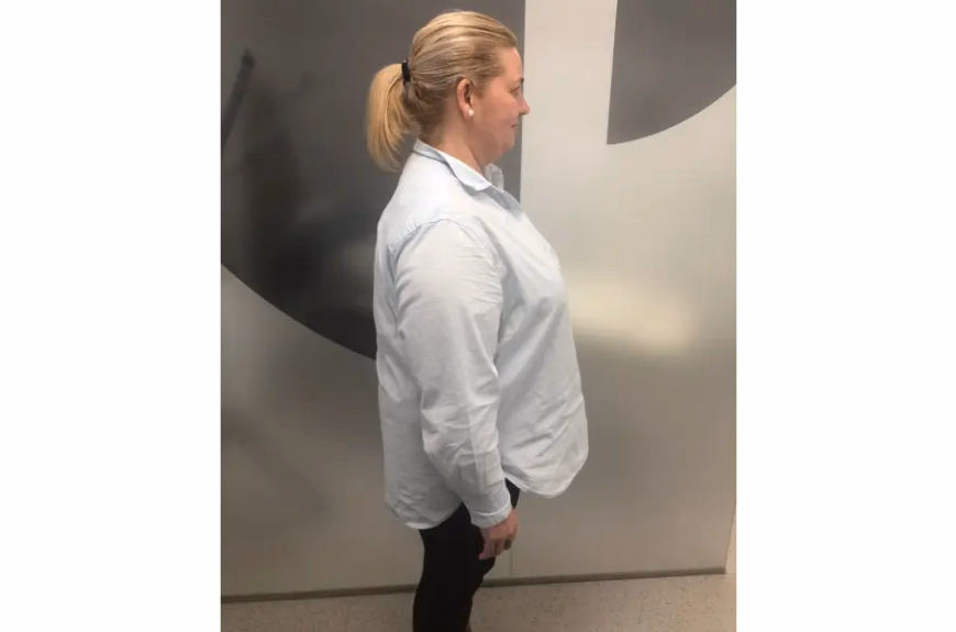 Antes de Va perdre 28kg