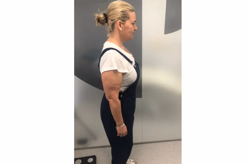 Después de Va perdre 28kg