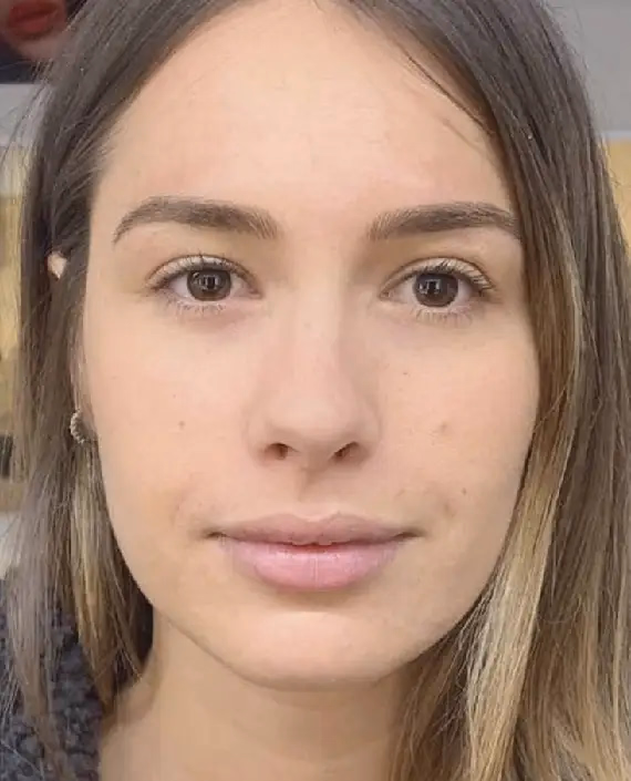 Después de Nanoblanding