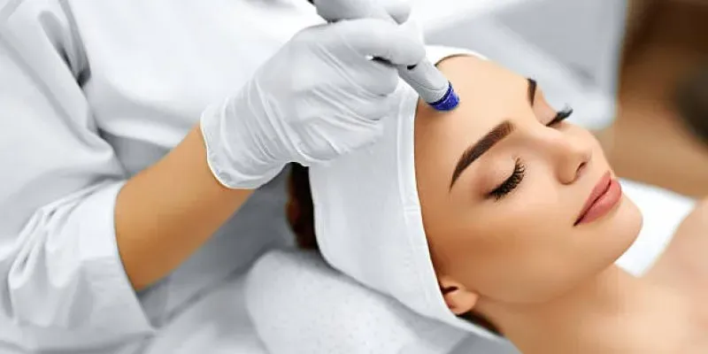 ¿Qué es un Peeling Facial? Todo lo que necesitas saber