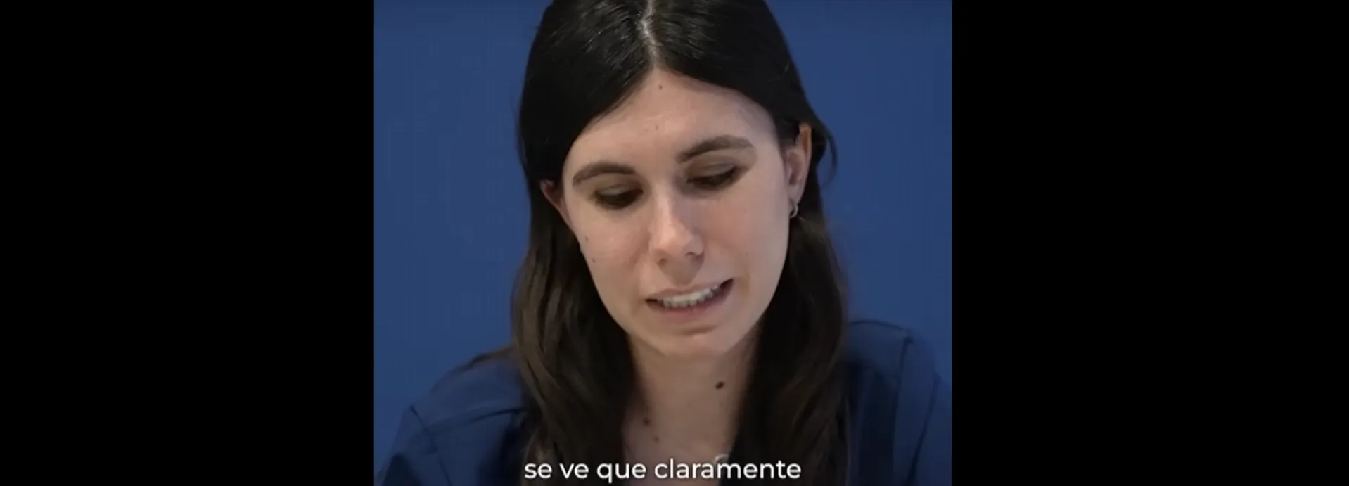 Quines operacions té Paula Echevarría? L'opinió de la doctora