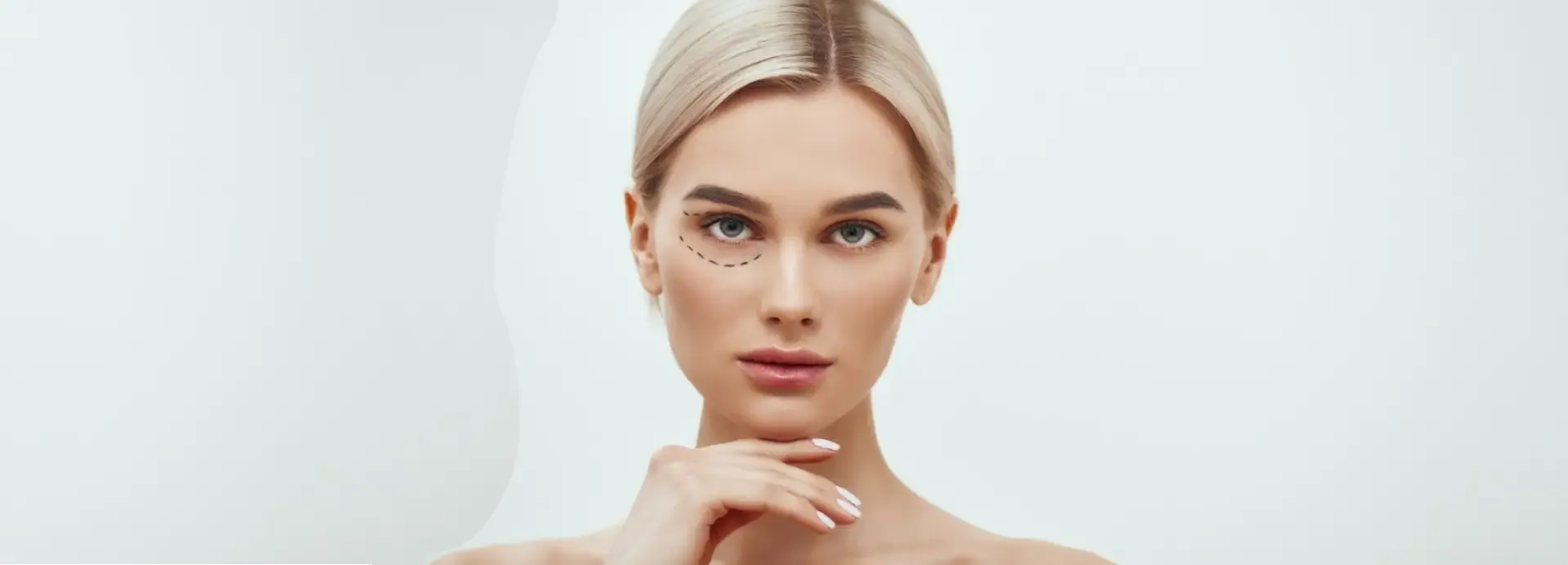 ¿Pueden volver a salir las bolsas tras la blefaroplastia?