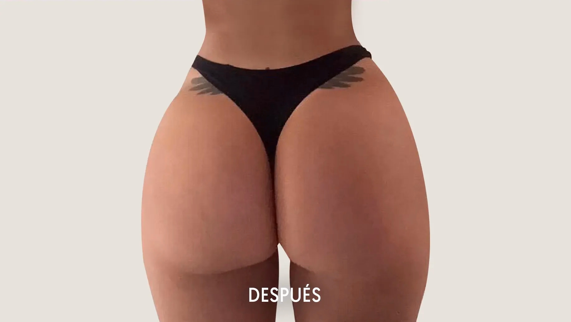 Después de Augment de glutis
