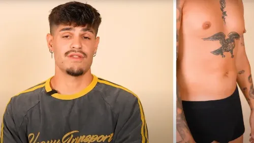 Álvaro Rubio undergoes a second liposuction surgery