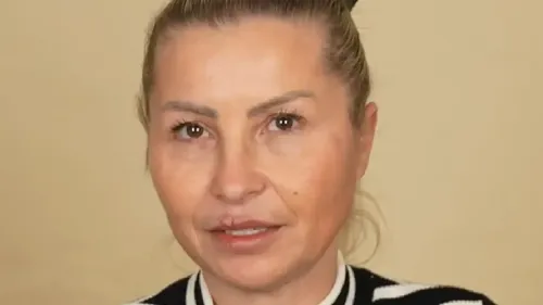 Flori’s experience with her surgery